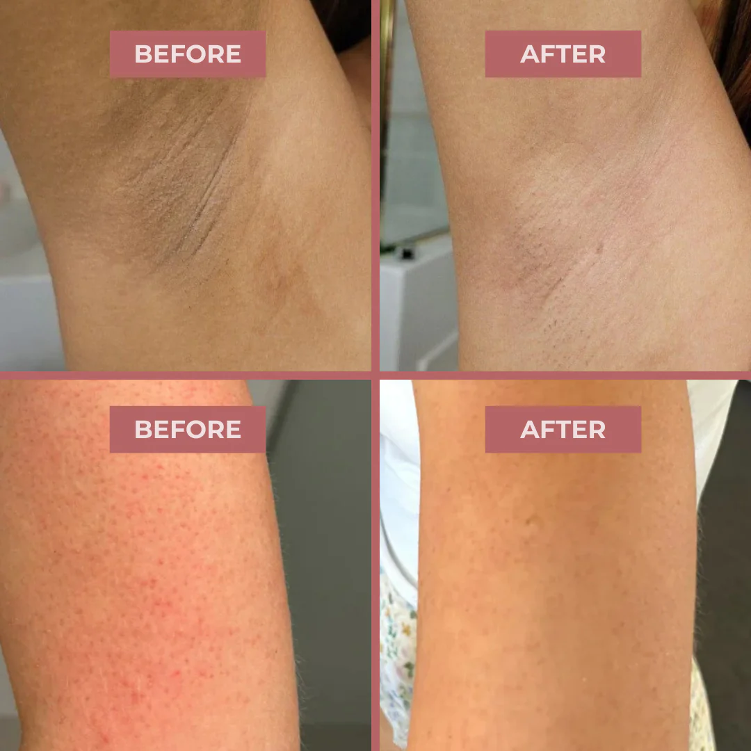 Body Spray - Kojic + Turmeric - Image 6