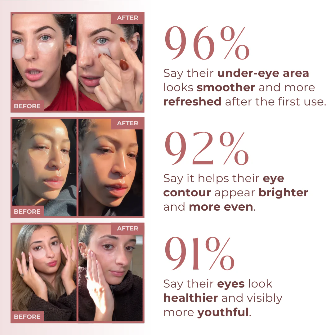 InstantFirm Collagen Eye Patches - Image 2