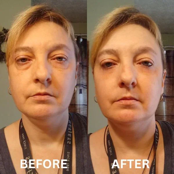 InstantFirm - Collagen Eye Patches - Image 12