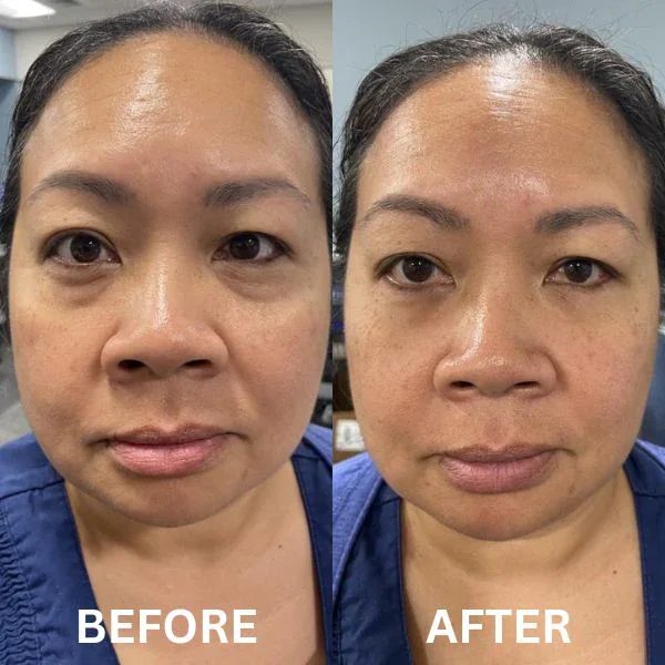 InstantFirm - Collagen Eye Patches - Image 13