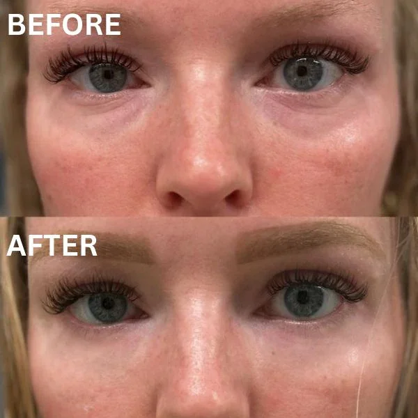 InstantFirm - Collagen Eye Patches - Image 10