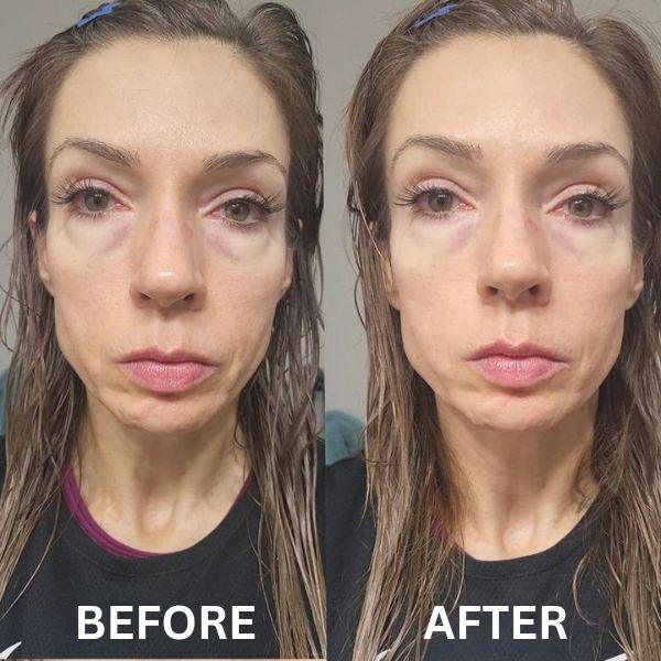 InstantFirm - Collagen Eye Patches - Image 11