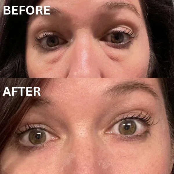 InstantFirm - Collagen Eye Patches - Image 14